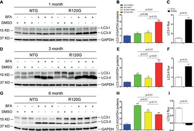 Highly Dynamic Changes in the Activity and Regulation of Macroautophagy in Hearts Subjected to Increased Proteotoxic Stress